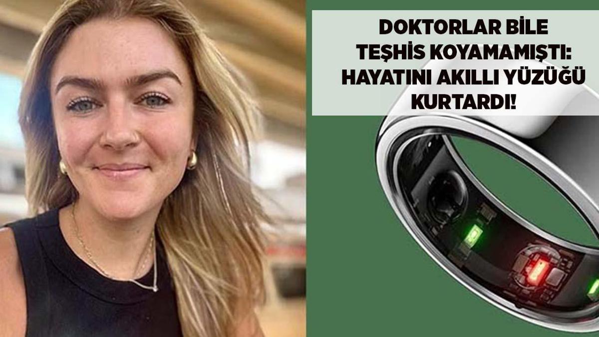 Həkimlərin çarəsiz qaldığı xəstəlikdən gənc qadını ağıllı üzük qurtardı