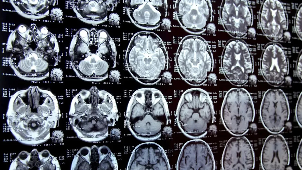 Üç il vərdişlərimi dəyişdim