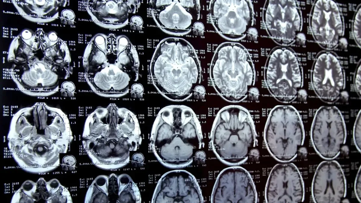 Üç il vərdişlərimi dəyişdim