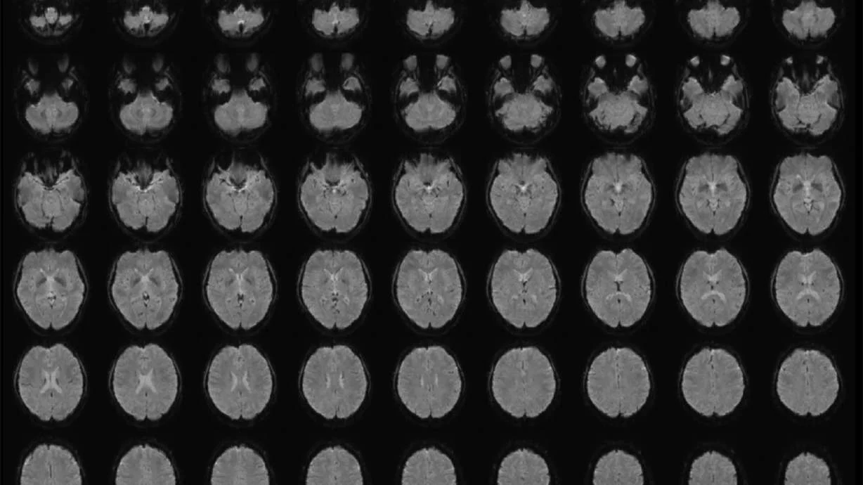 Alim süni intellektlə düşüncələri mətnə çevirir