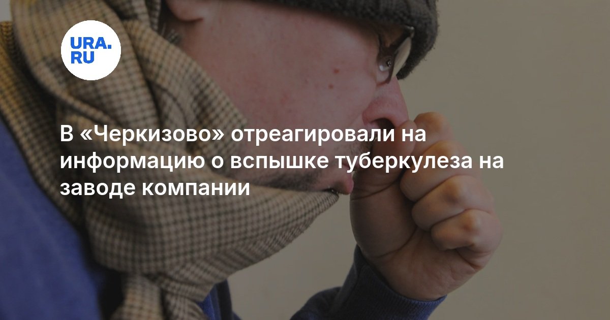 "Çerkizovo" zavoddakı vərəm iddialarına reaksiya verdi