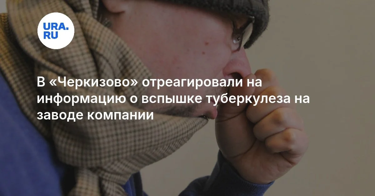 "Çerkizovo" zavoddakı vərəm iddialarına reaksiya verdi