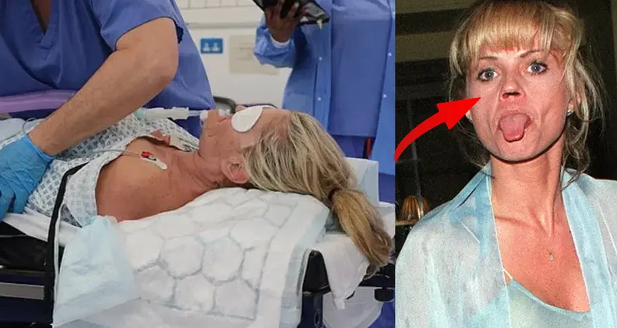 Məşhur ulduzun burnundan sümük itdi