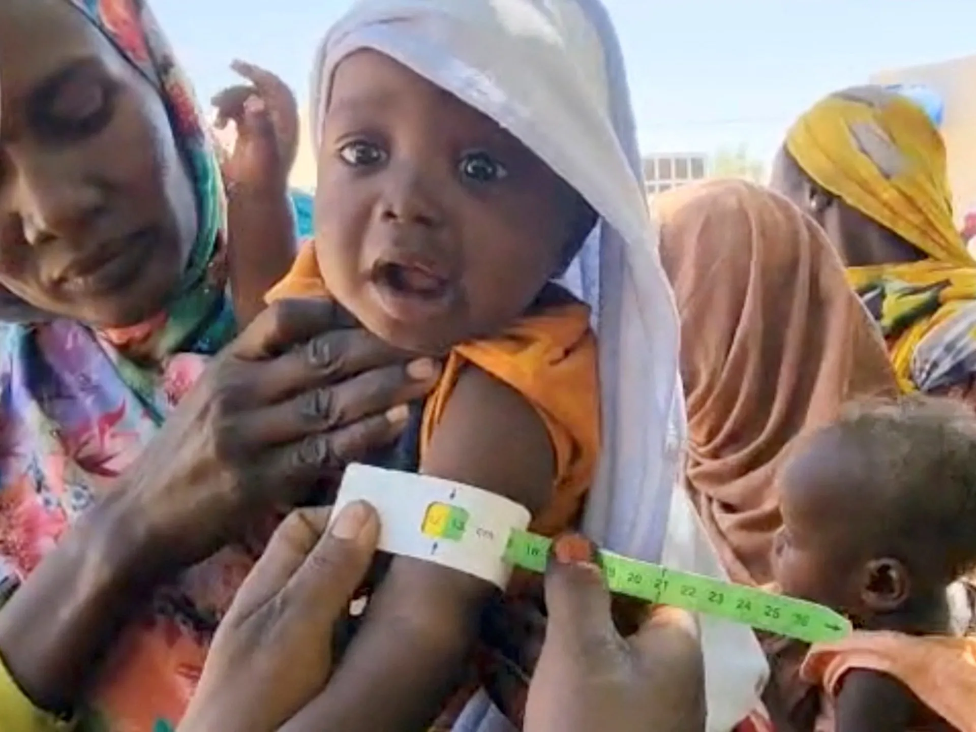 El-Faşirdə 500 günlük mühasirə sonrası uşaqlar aclıq çəkir: UNICEF