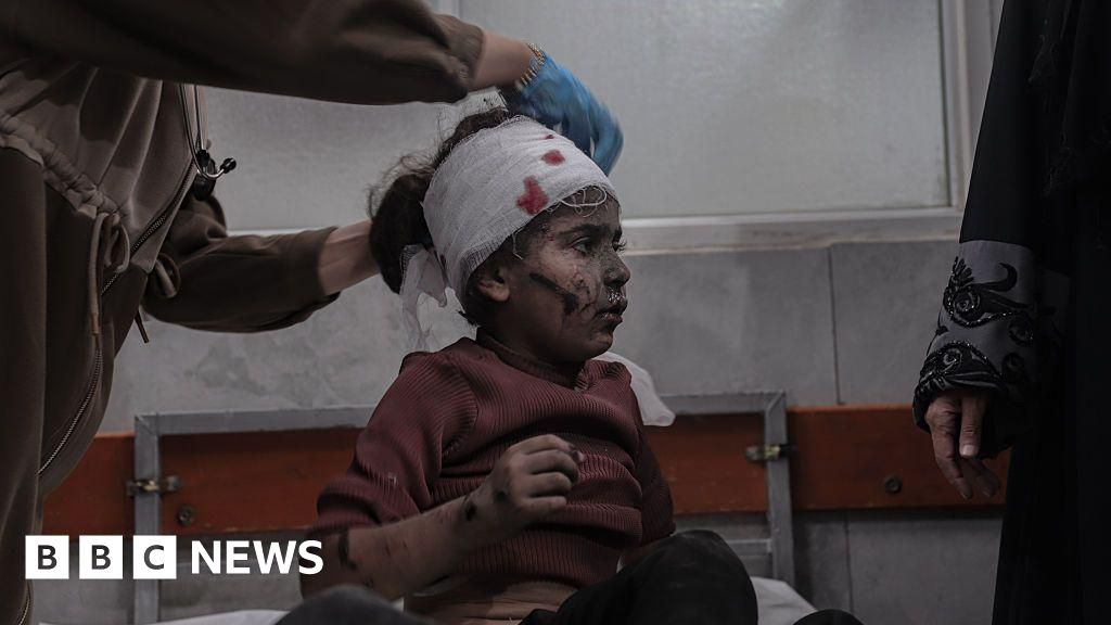 Qəzzada İsrail zərbələri 25 fələstinlini həlak etdi Nazirlik