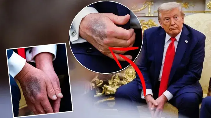 Tramp əlindəki müəmmalı göyərmələri izah etdi