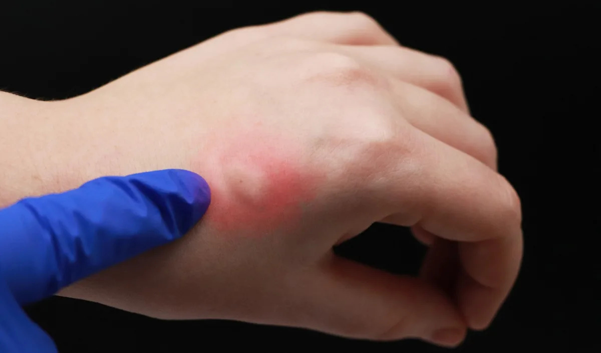 ABŞ-da xəstəlik yayıcı təhlükə: Səlahiyyətlilərdən xəbərdarlıq