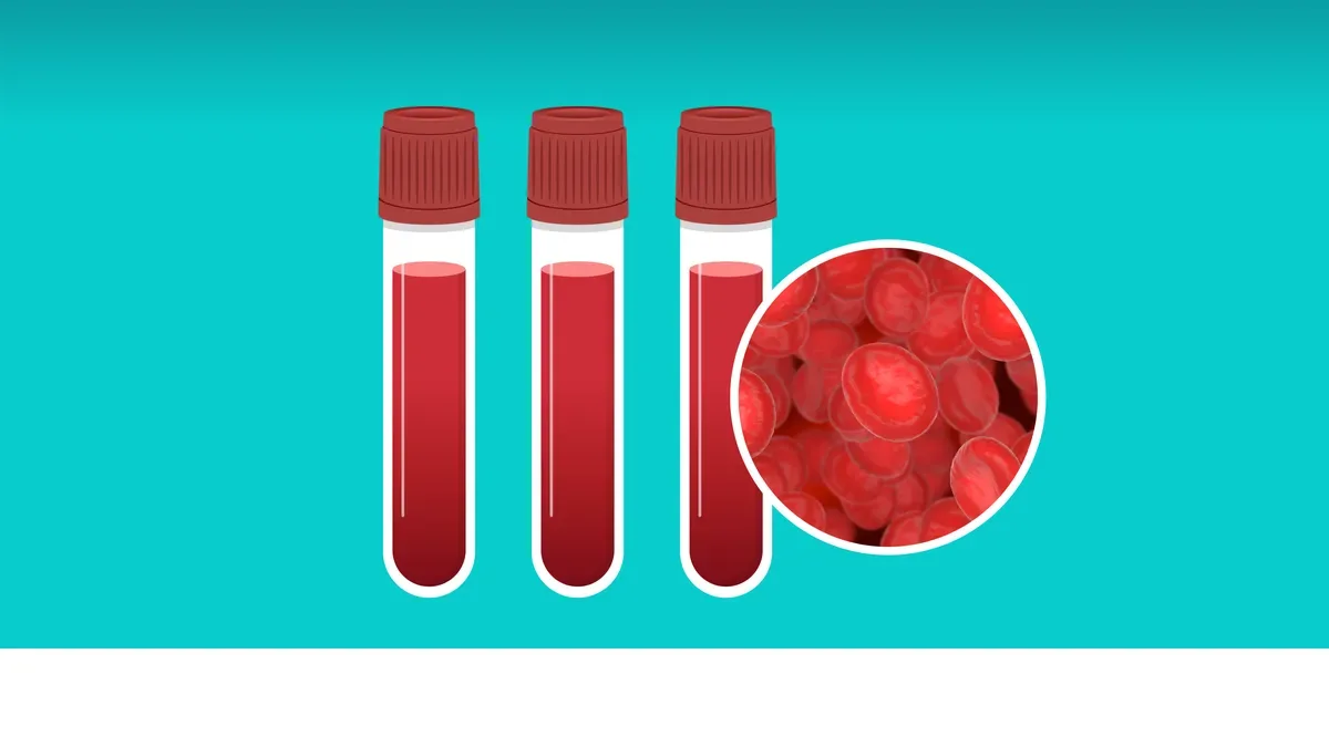 Yeni Qan Testi 50-dən Çox Xərçəngi Erkən Aşkarlaya Bilir