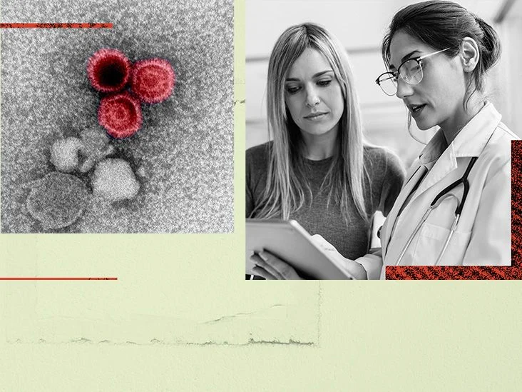 Epstein-Barr virusu lupusun səbəbkarı?