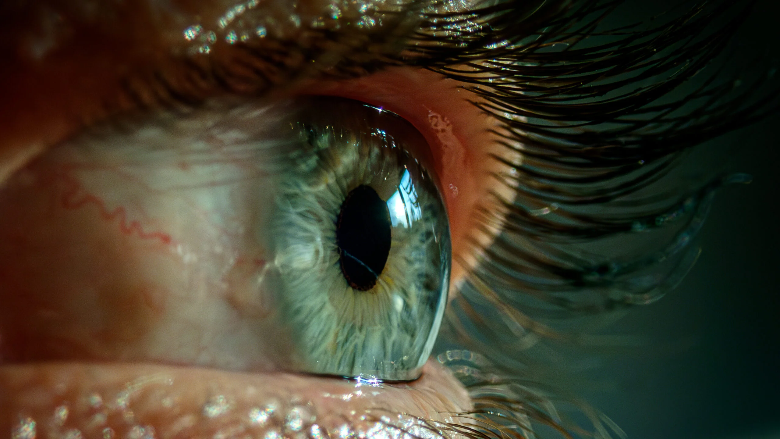 Yuxusuzluqdan qadının göz qapaqları çölə çevrilib yapışdı