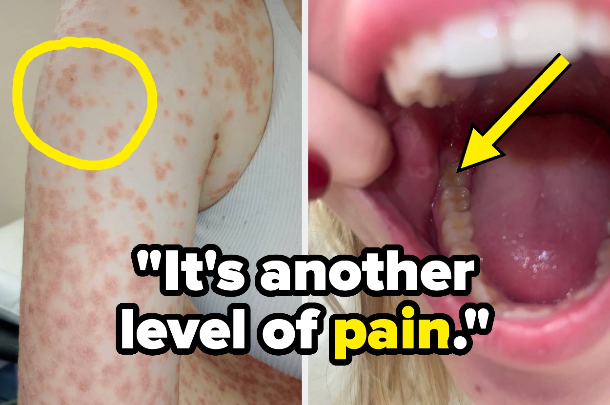 “Kiçik” hesab edilən xəstəliklərin 21 acı həqiqəti