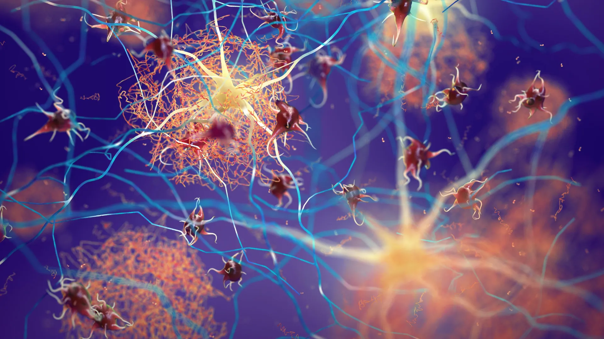 Bir zülalın artırılması Altsaymerə qarşı beyni gücləndirir