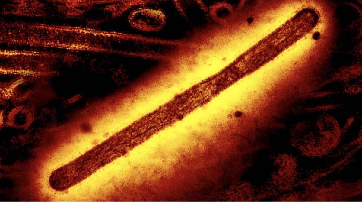 Dünyada ilk H5N5 quş qripi ölümü ABŞ-da