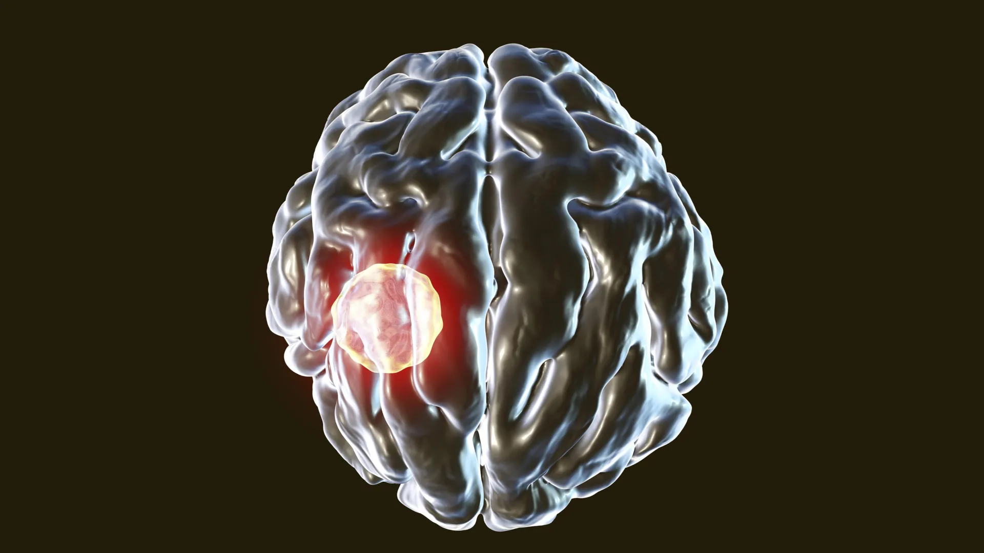 Hər üç insandan birində olan beyin paraziti: Orqanizmin gizli müdafiə mexanizmi