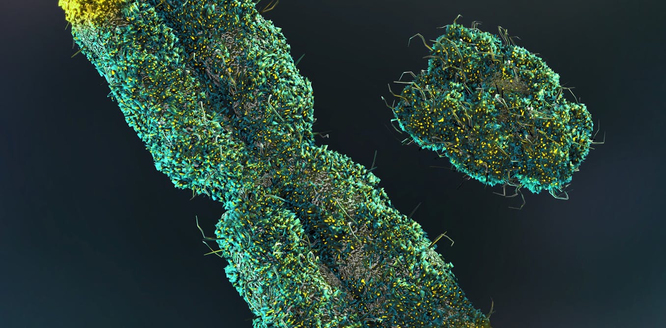 Yaşlı kişilərdə Y xromosomu itkisi: Zərərsiz sanılan prosesin gizli təhlükələri