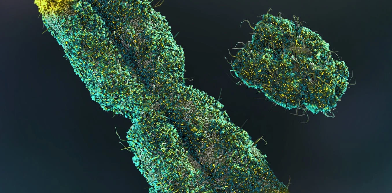 Yaşlı kişilərdə Y xromosomu itkisi: Zərərsiz sanılan prosesin gizli təhlükələri