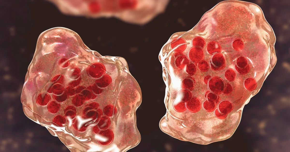 Kaliforniya: Disneylenddə ikinci qızılca həyəcanı