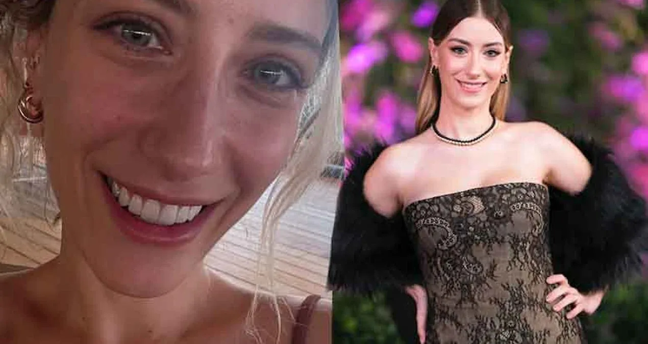 Hazal Kaya dişlərini yenilətdi: "Ölürəm sandım"