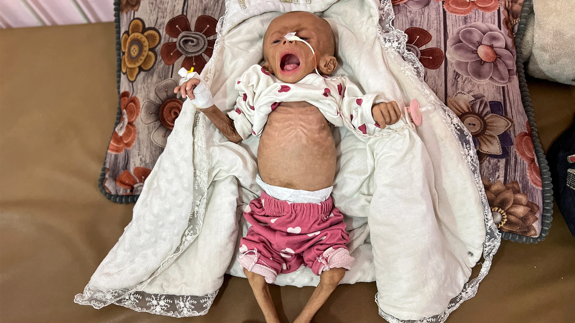 BMT: Qəzzada hər 10 uşaqdan biri acdır
