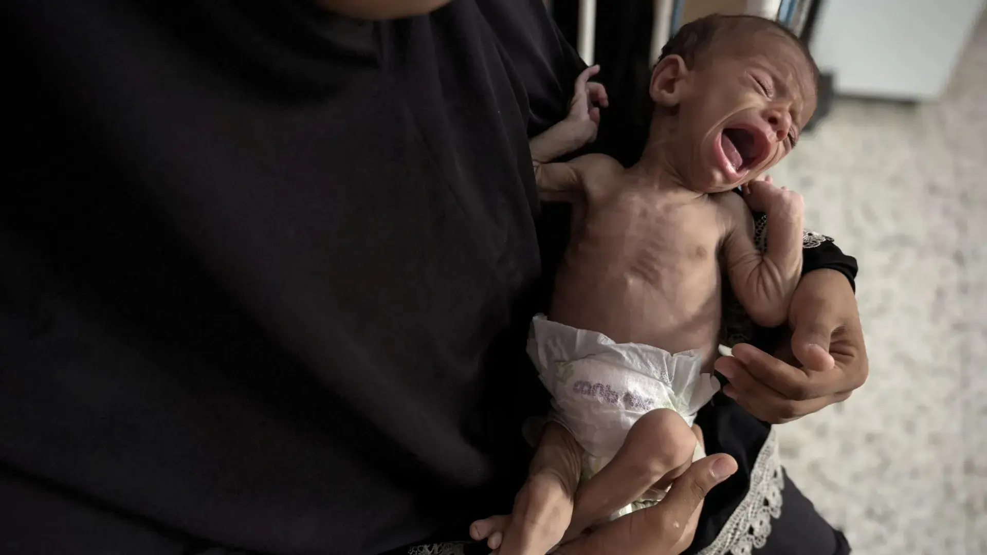 Atəşkəsə rəğmən Qəzzanın xəstə uşaqları köməyə möhtac