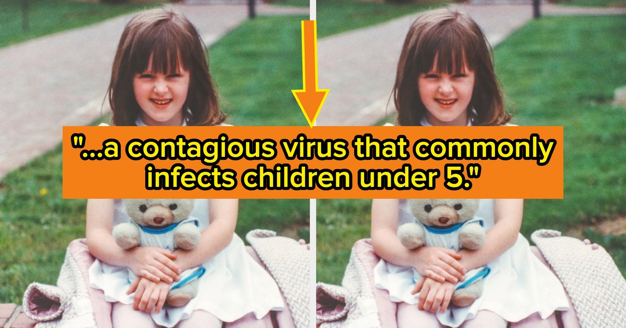 Həkimlər: Çox yoluxucu virus yayılır