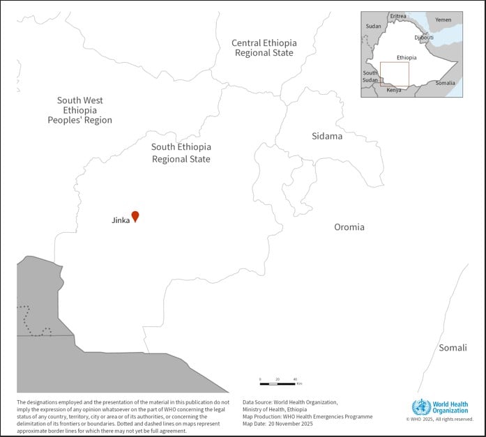 Efiopiyada Marburq virusu