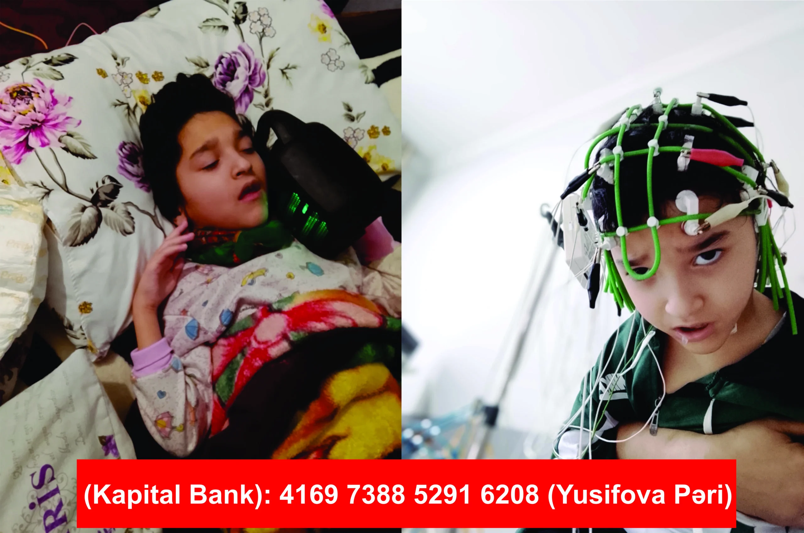 I qrup əlil olan balaca Camalın sizə ehtiyacı var – Anadan Çarəsiz Fəryad