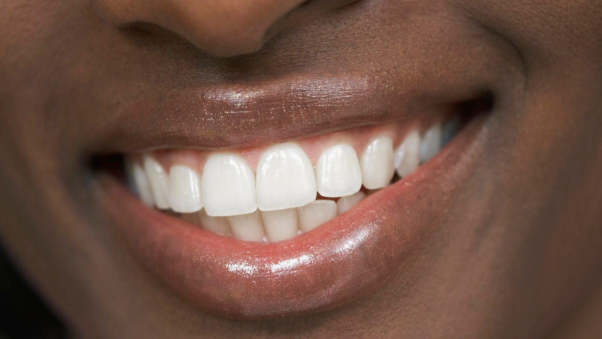 Qəhvə-şərab sevənlər üçün ağ dişlər: Ləkələrdən qorunma yolları